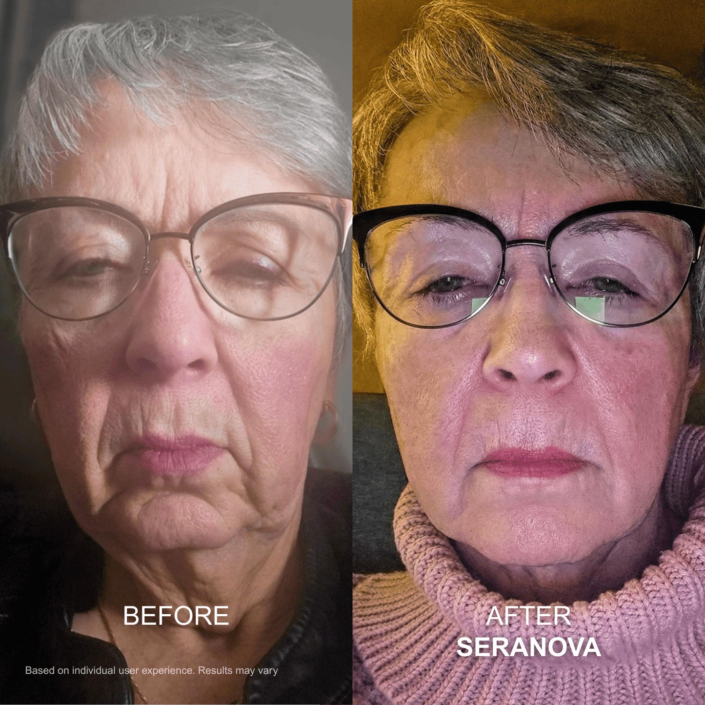 The Micro Infusion System™