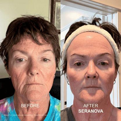 The Micro Infusion System™